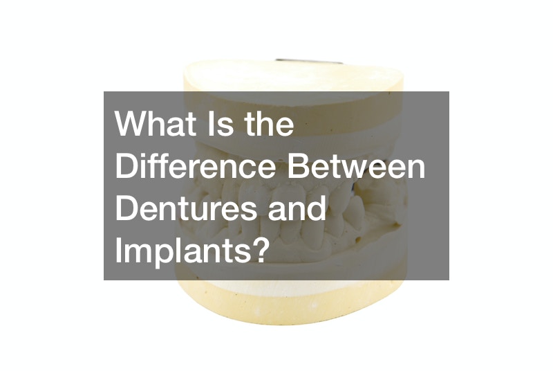 What Is the Difference Between Dentures and Implants?