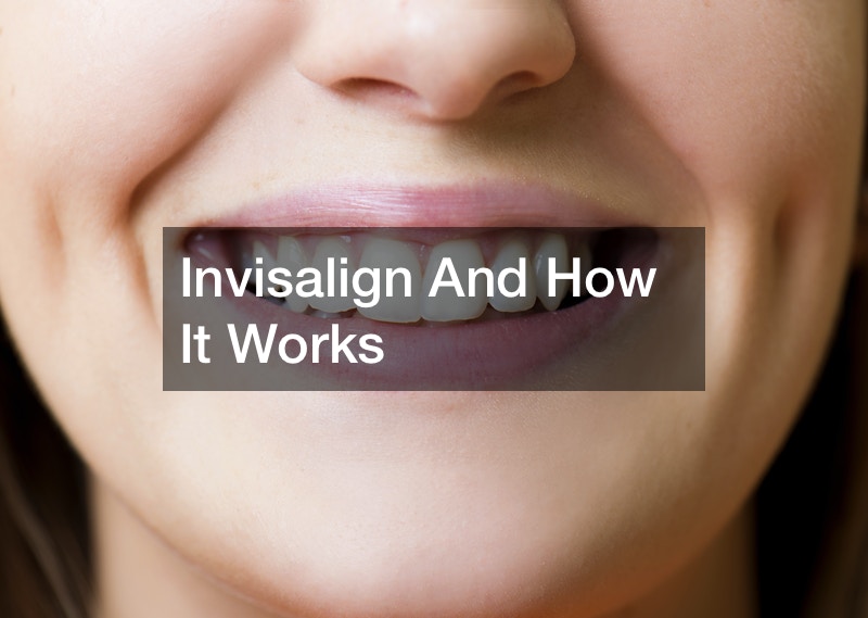 Invisalign And How It Works