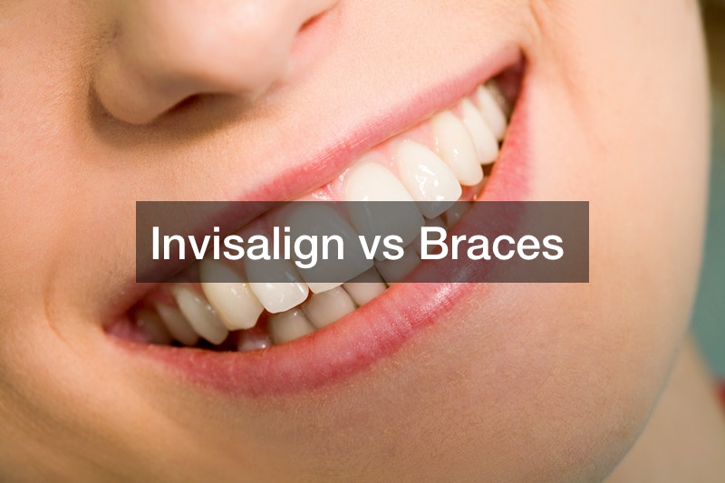 Invisalign vs Braces