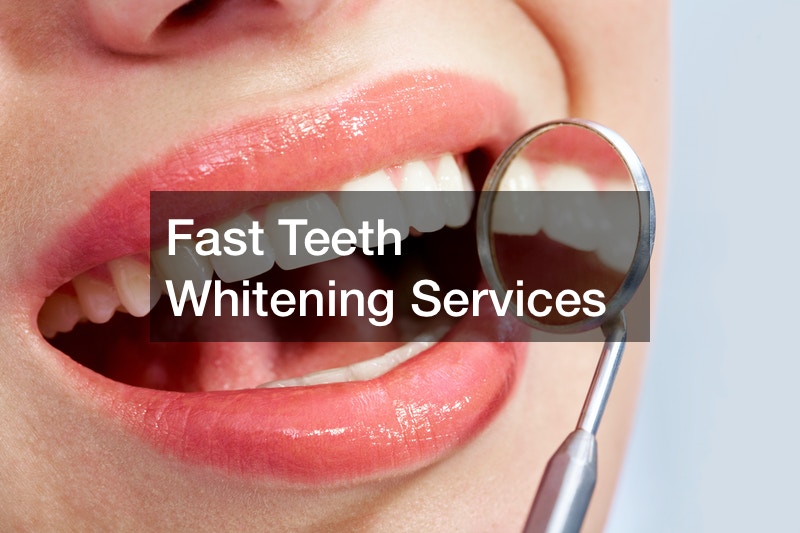 Fast Teeth Whitening Services