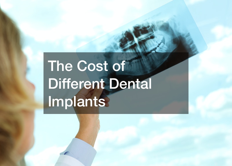 The Cost of Different Dental Implants