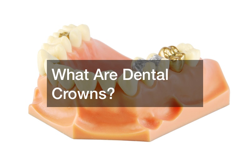 What Are Dental Crowns?