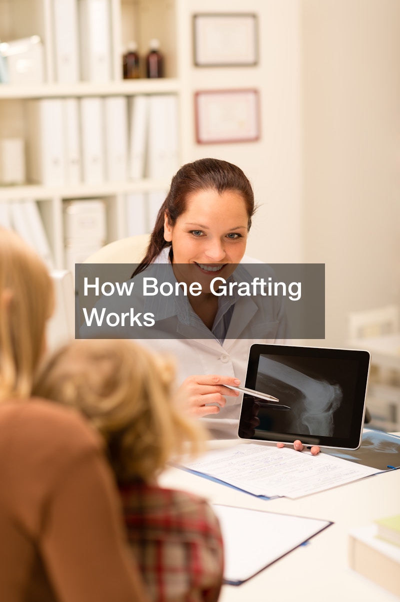 How Bone Grafting Works