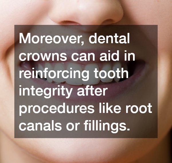 How Dental Crowns Improve the Look and Function of Your Smile